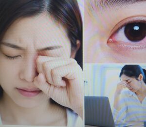 여름철 눈이 가렵고 충혈될 때